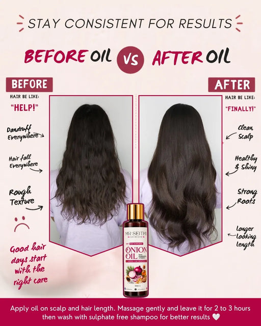 Onion Infused Hair Oil