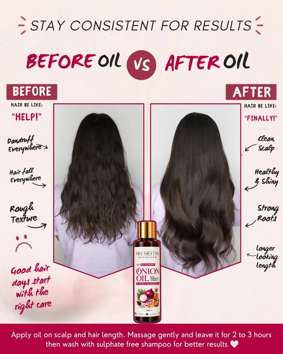 Onion Infused Hair Oil